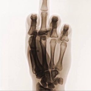 Meet your Posher, Bobby